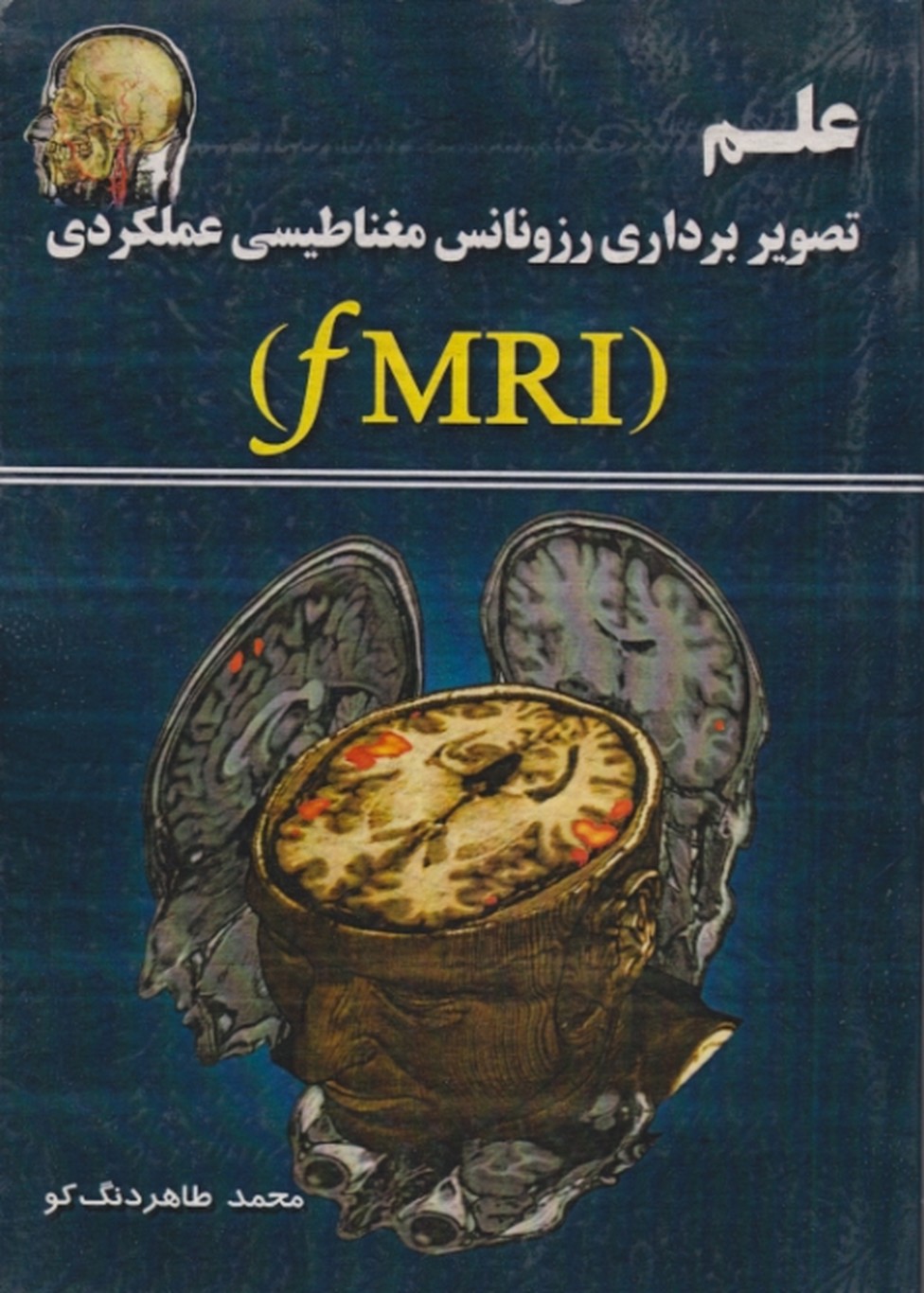 علم تصویربرداری رزونانس مغناطیسی عملکردی(FMRI)