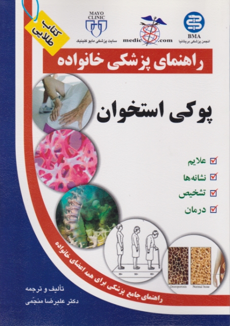 راهنمای پزشکی خانواده(پوکی استخوان)سلیس